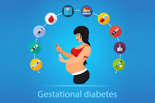 pregnant woman with gestational diabetes